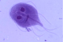 giardia drinking-water-giardia